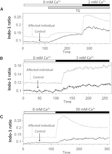 Constitutive activation of the calcium sensor STIM1 causes tubular-aggregate myopathy